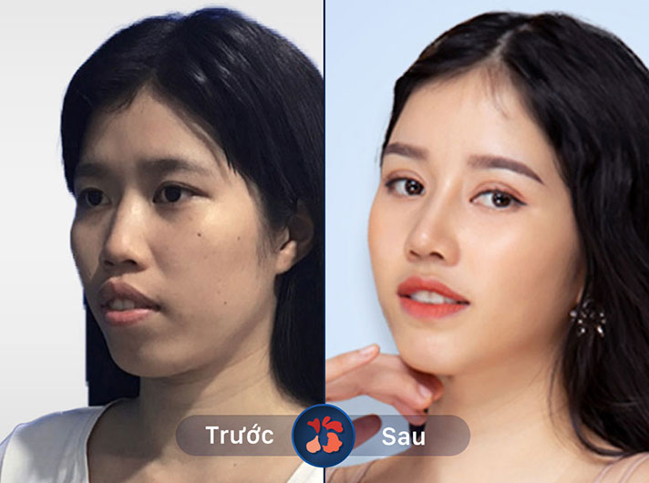 Ms.Nguyễn Yến Hồng - Sau khi thẩm mỹ, khách hàng cảm thấy như được tái sinh với diện mạo mới