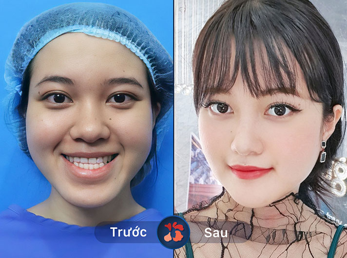 Ms.Phạm Thanh Tâm - Nhờ làm hàm mặt, khách hàng thấy bản thân trẻ trung và quyến rũ hơn