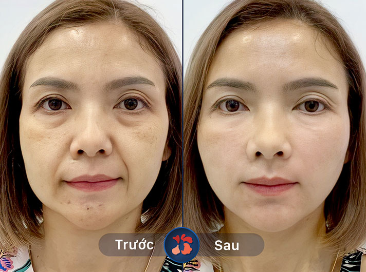 Ms.Hồng Nhung - Nhân viên tận tâm và chuyên nghiệp, khách hàng rất hài lòng với kết quả.