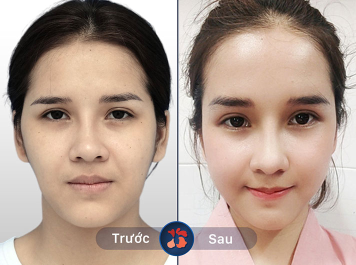 Ms.Thu Trang - Dịch vụ chu đáo, da cải thiện rõ rệt sau lần đầu