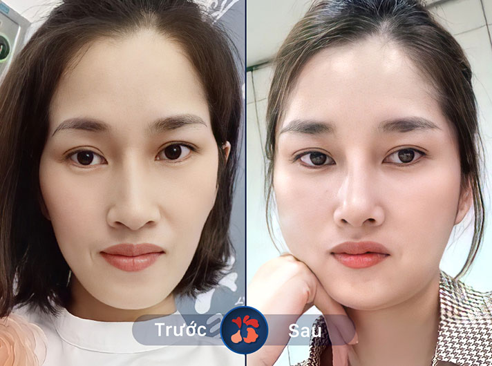 Ms.Minh Châu - Nhân viên tư vấn kỹ lưỡng và thực hiện rất chuyên nghiệp