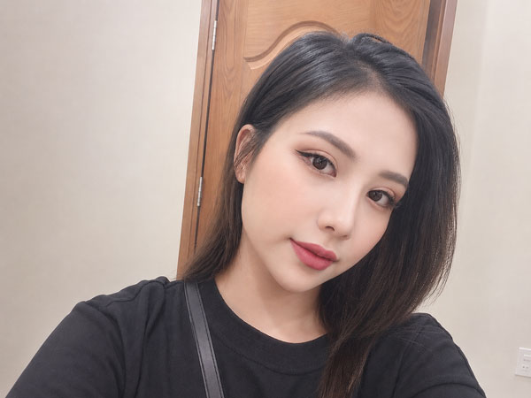 Khách hàng Thanh Hoa trước và sau nâng mũi kết hợp cắt mí 6D tại Kangnam Hà Nội