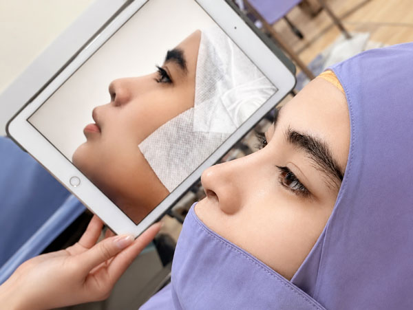 Kết quả nâng mũi của khách hàng Kangnam Thanh Hóa