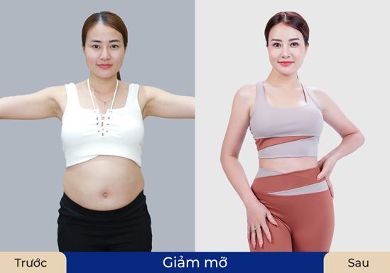 Khách hàng tự tin khoe vóc dáng sau khi sử dụng dịch vụ giảm mỡ