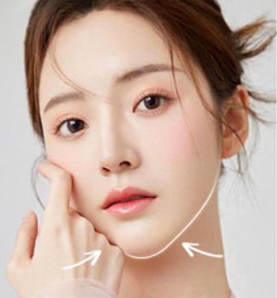 Thu Gọn Góc Hàm VLine