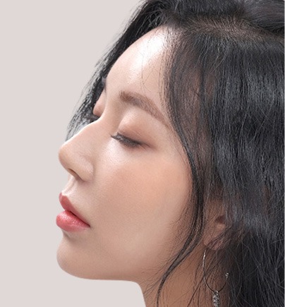 Mài Gồ Chỉnh Xương Mũi