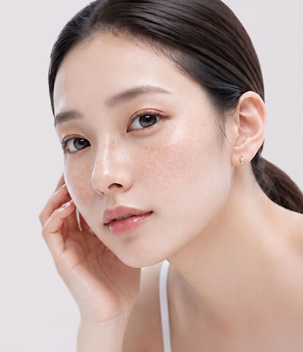 Điều trị nám và tàn nhang tại Bệnh viện Thẩm mỹ Kangnam