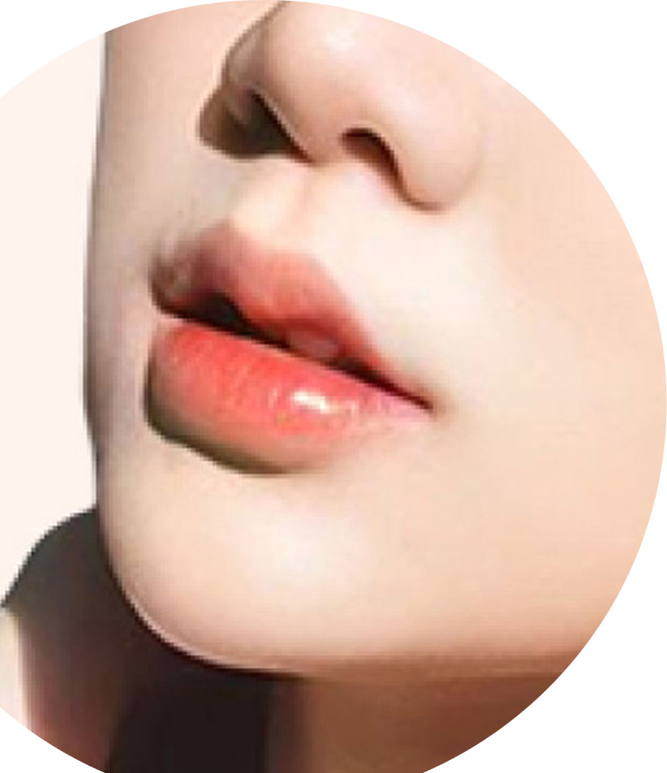 Tạo hình môi