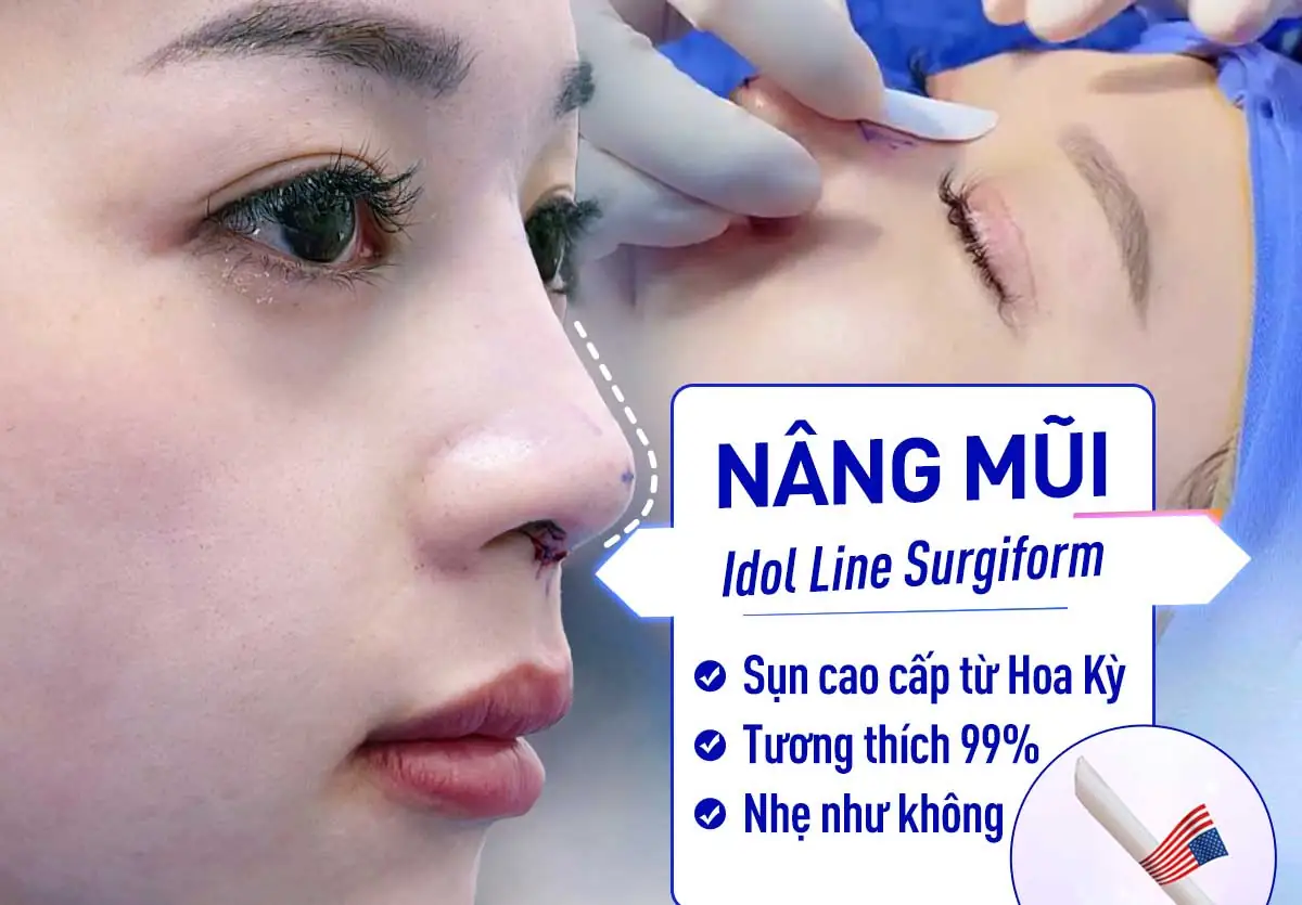 Trước sau cắt cánh mũi 3