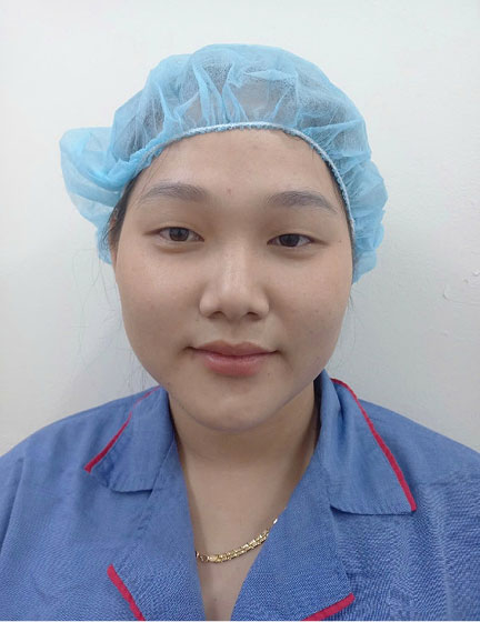 Trước sau cắt cánh mũi 1