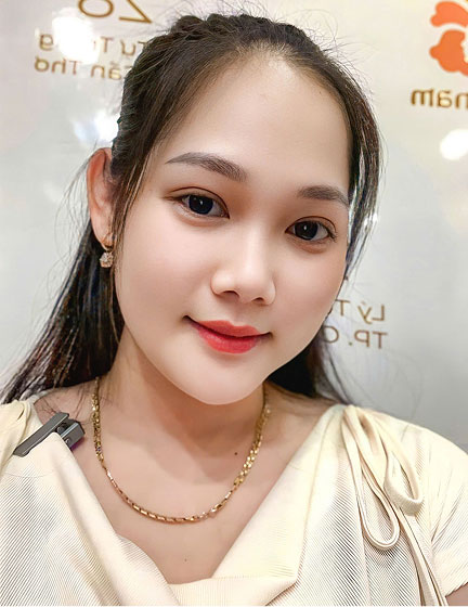 Trước sau cắt cánh mũi 4