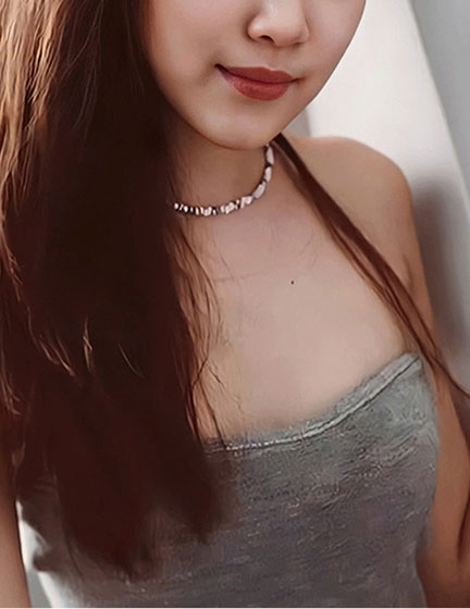 Trước sau cắt cánh mũi 3