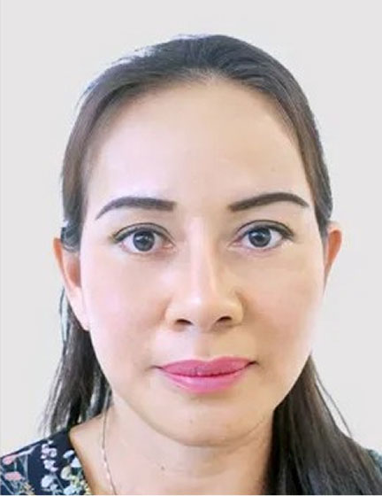 Trước sau cắt cánh mũi 2