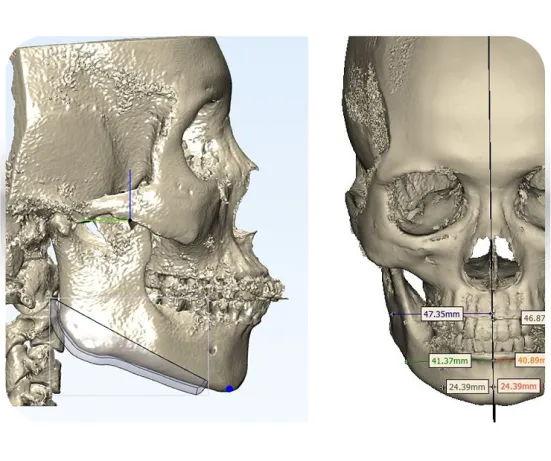 3D Face design thiết kế khuôn mặt 3D