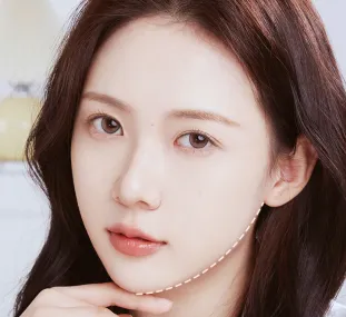 Chỉnh hình hàm mặt