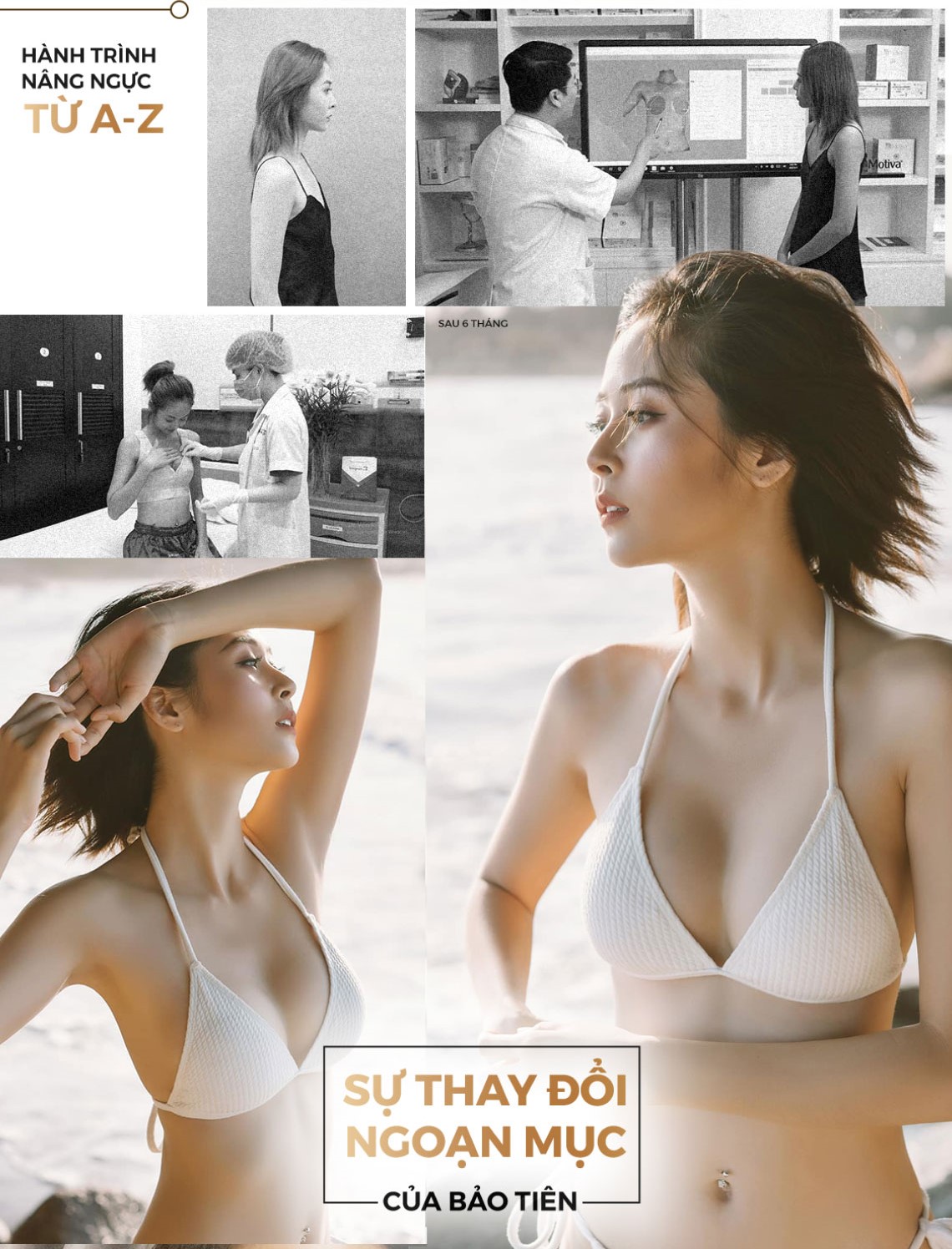 Quá trình Bảo Tiên đi nâng ngực tại Kangnam