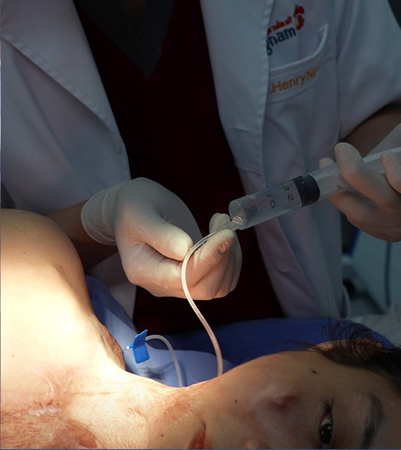 CẮT BỎ SẸO XẤU CHO DIỆU LINH