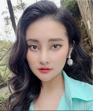 Hồng Anh lột xác với dáng mũi đẹp cao sau nâng