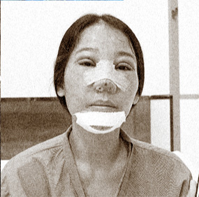 KẾT QUẢ CAO,
                        AN TOÀN