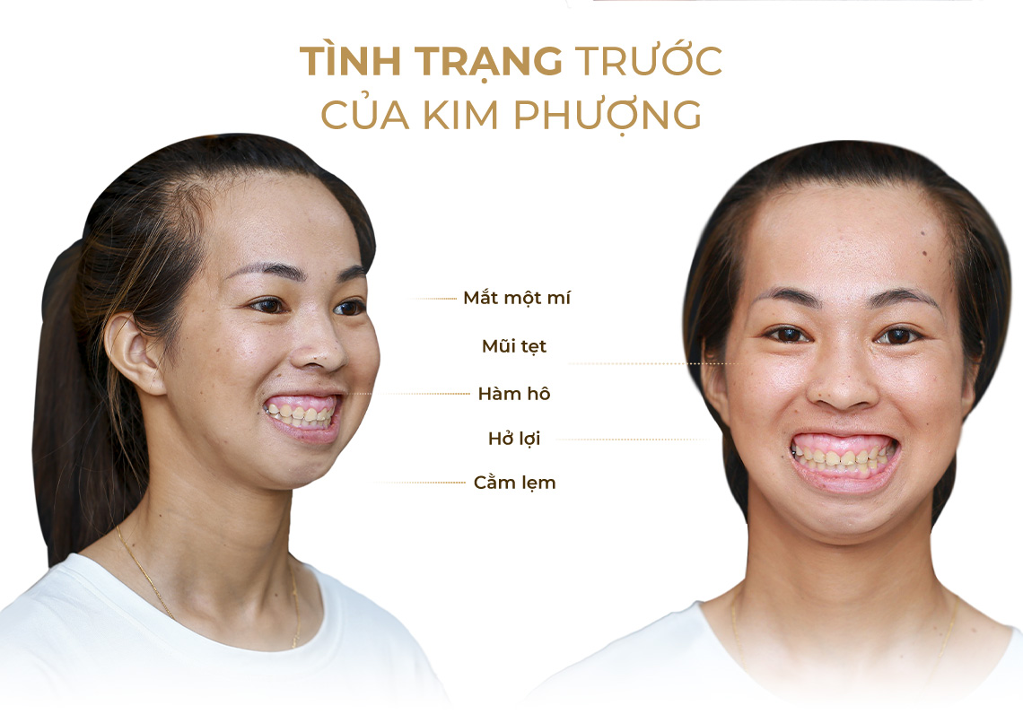 tình trạng trước của Kim Phượng