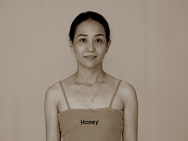 VÒNG 1 SA TRỄ SAU SINH