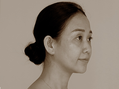 LỖ CHÂN LÔNG TO, DA KHÔNG ĐỀU MÀU