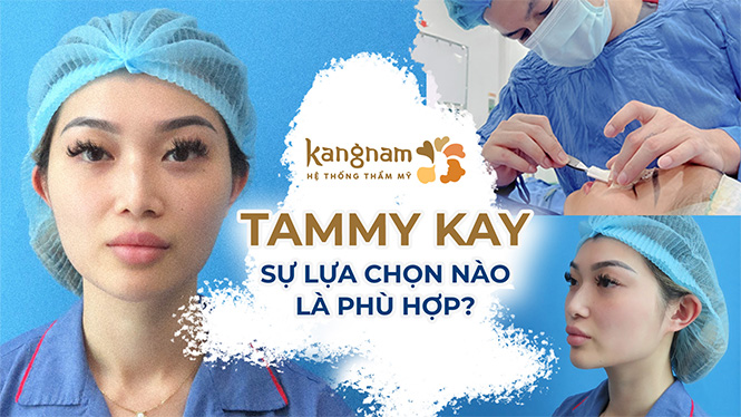 Tammy Kay sự lựa chọn nào là phù hợp