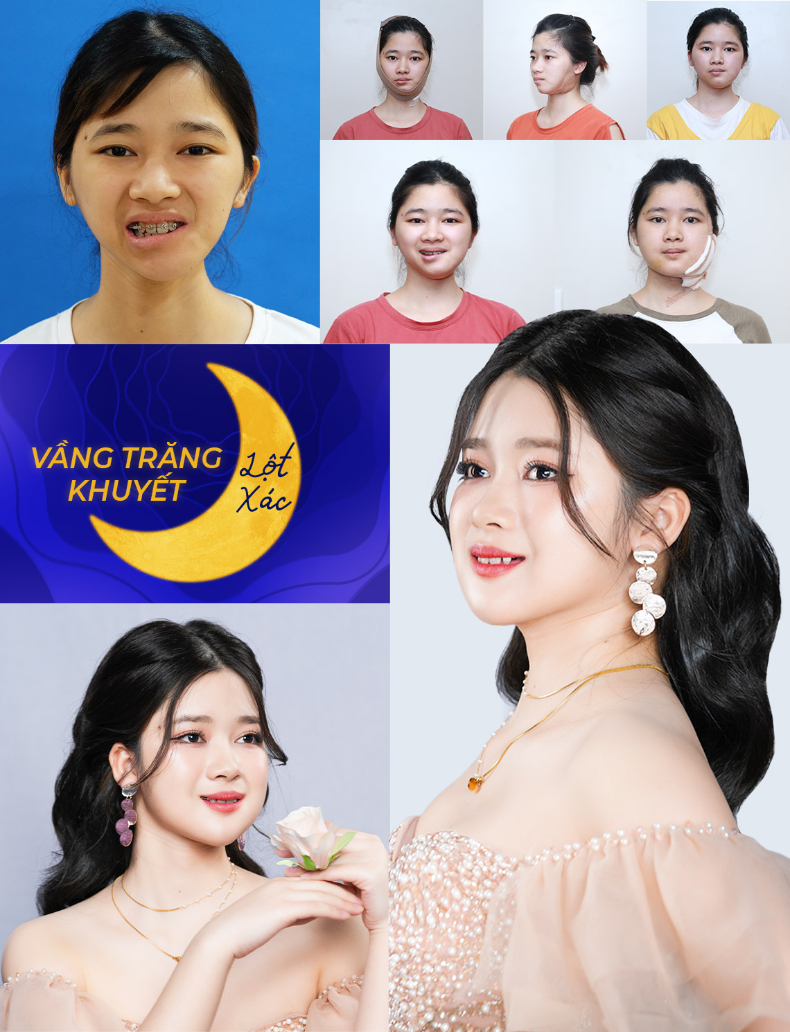 KẾT QUẢ SAU 100 NGÀY THAY ĐỔI CỦA THU HƯỜNG