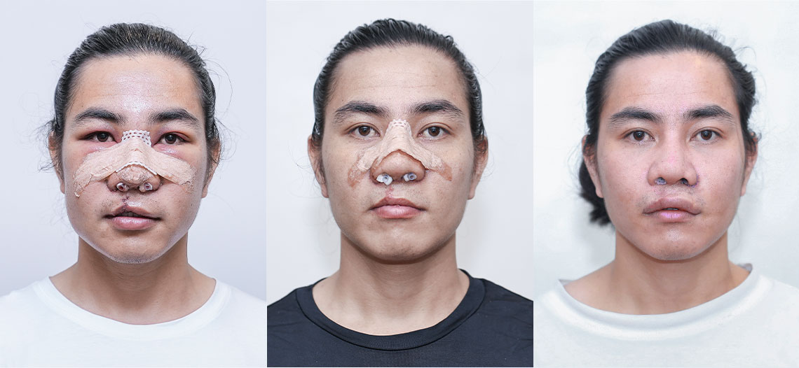 100 ngày thay đổi của tự