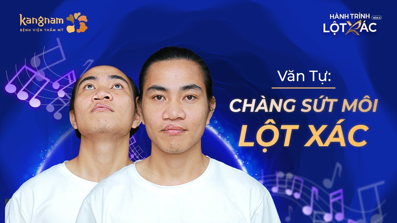 Văn Tự - chàng sứt môi lột xác