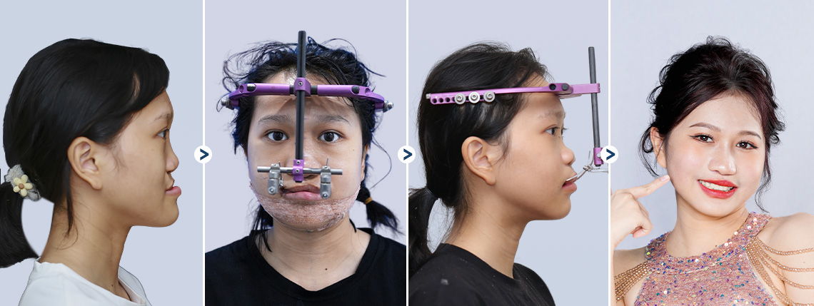 3 THÁNG THAY ĐỔI CỦA XUÂN MAI