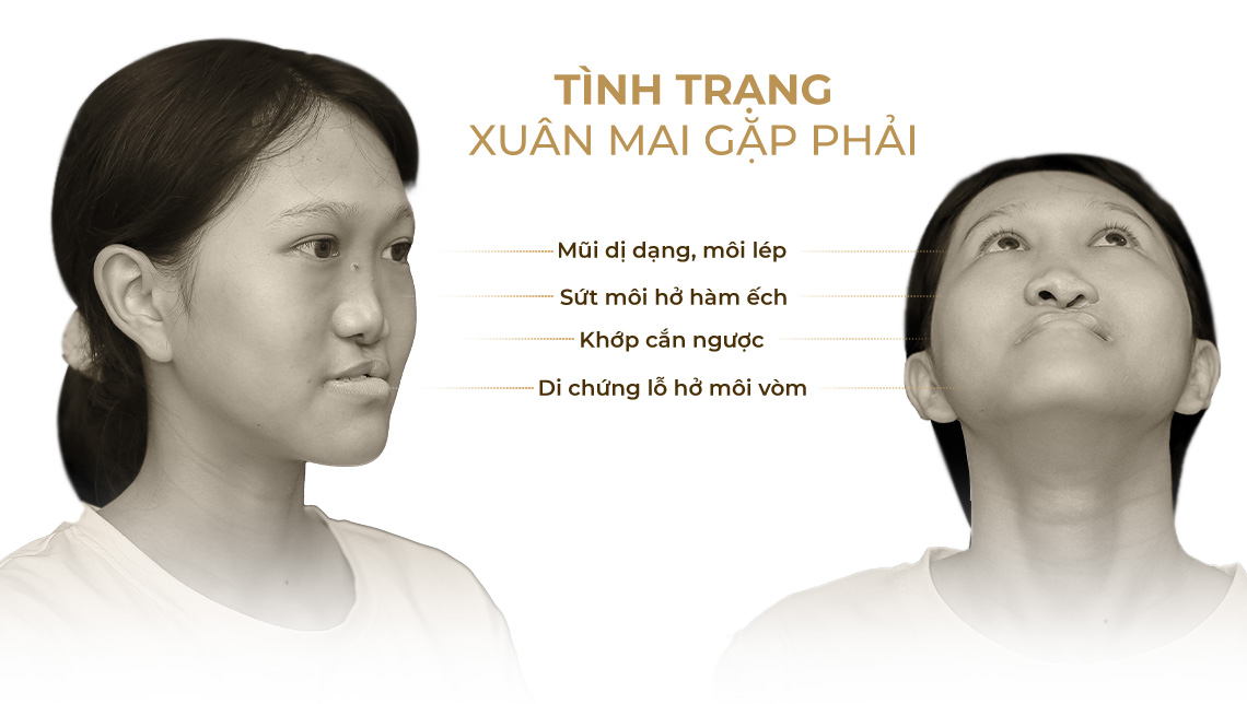 Tình trạng Xuân Mai gặp phải