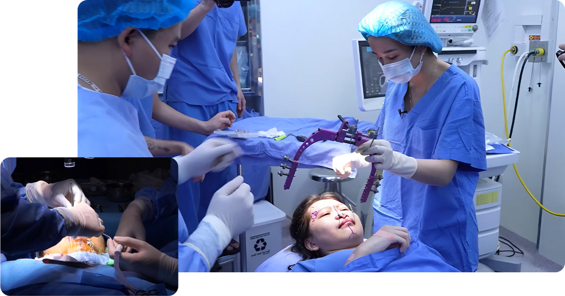 LẦN 2: THÁO KHÍ CỤ + NÂNG MŨI SỤN SƯỜN + CẤY MỠ MẶT + SỬA SẸO MÔI CHO XUÂN MAI