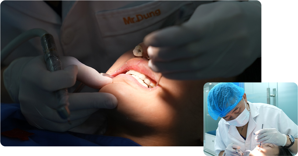 LẦN 3: XUÂN MAI LÀM RĂNG SỨ