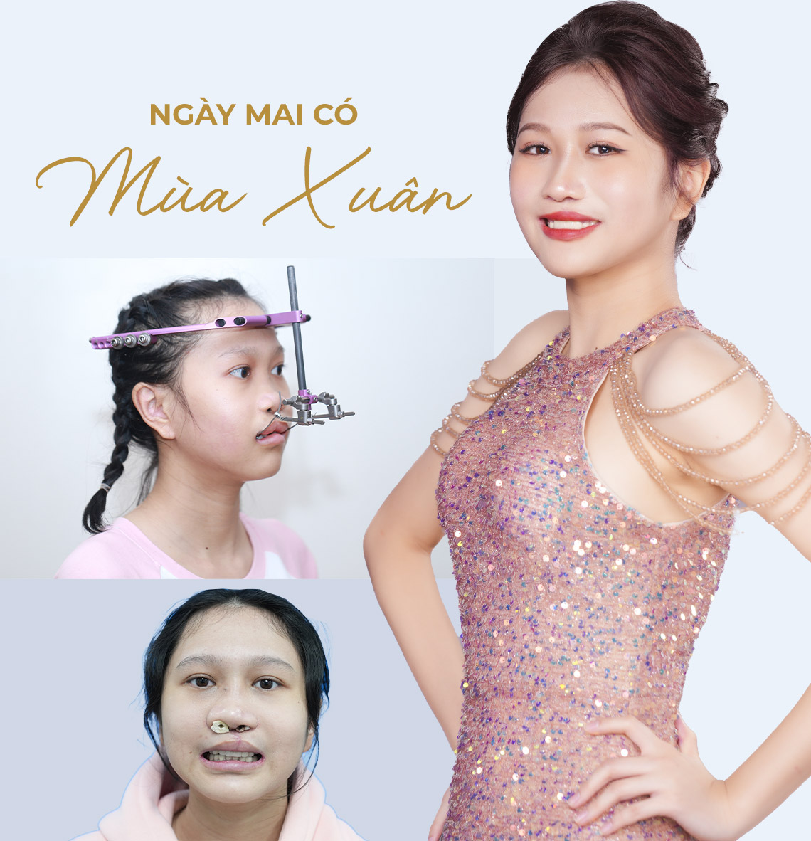 Ngày mai có mùa Xuân