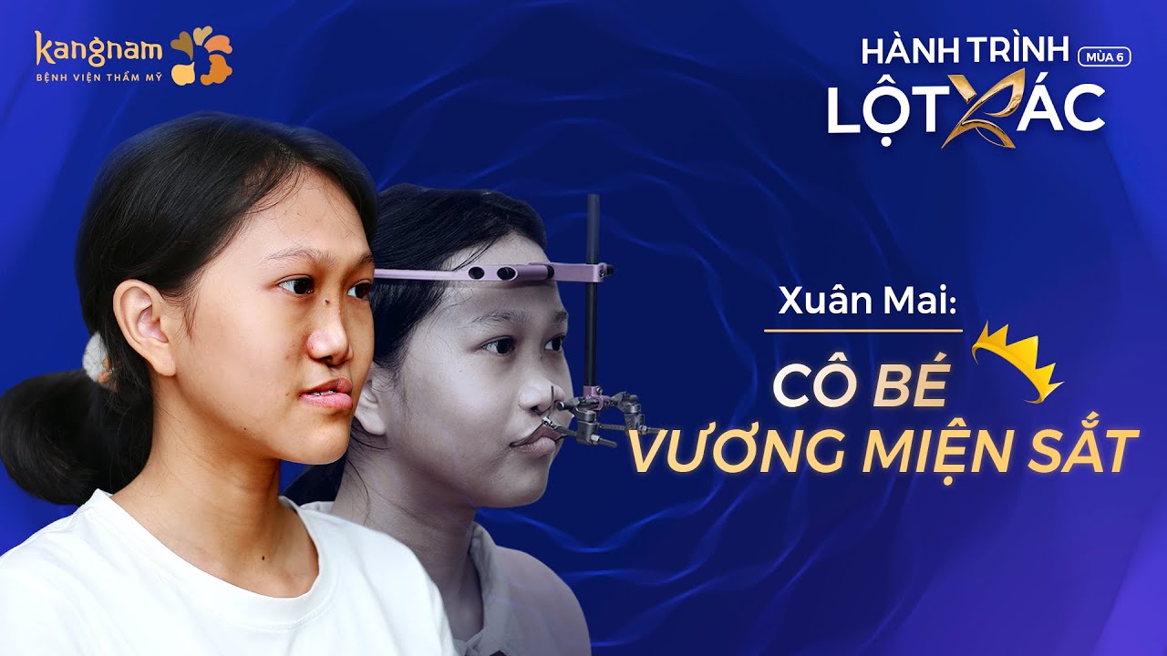 Xuân Mai cô bé Vương miện sắt