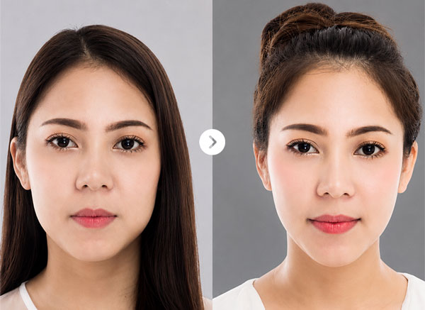 Before After Jaw 5