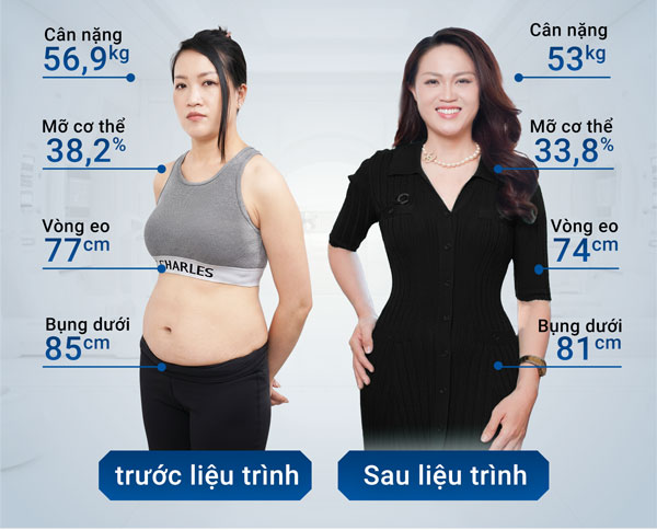 Flash Slim — kết quả trước & sau liệu trình