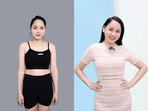 Before-After hút mỡ