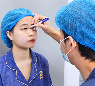 Đo vẽ dáng mắt