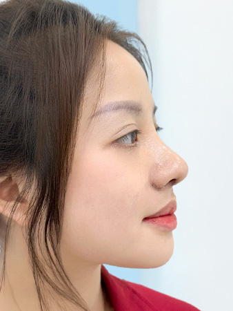 Trước