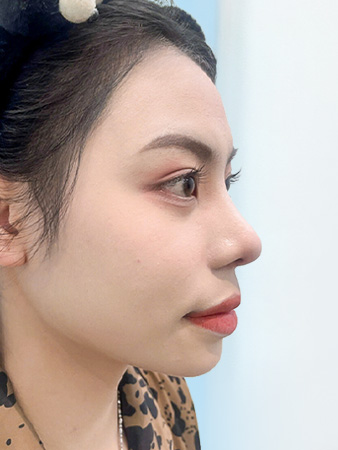 Trước