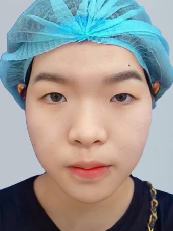 Trước