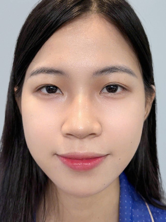 Trước