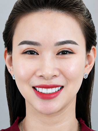 Trước