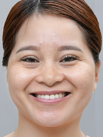 Trước