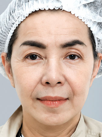 Trước