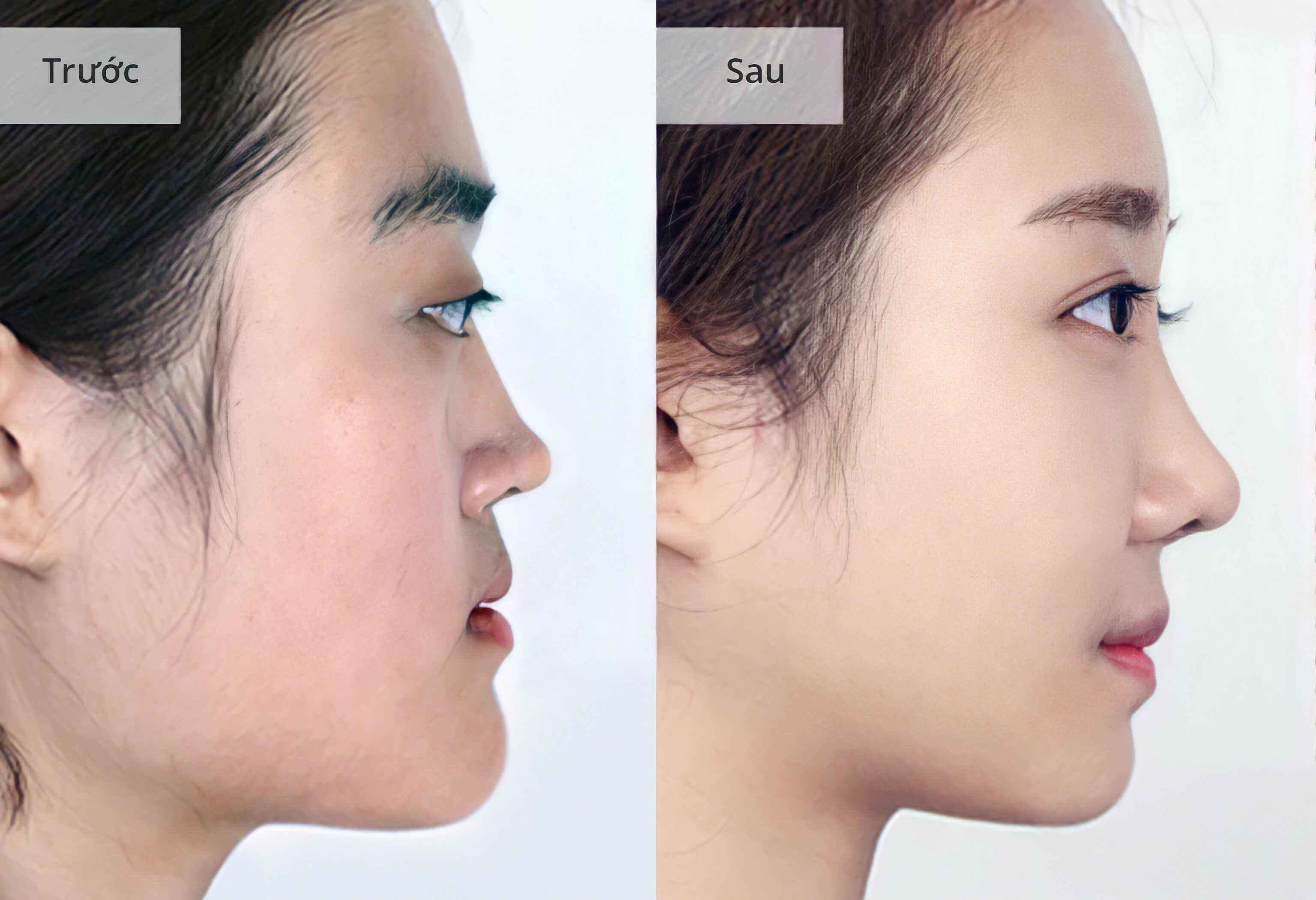 HÌNH ẢNH KHÁCH HÀNG