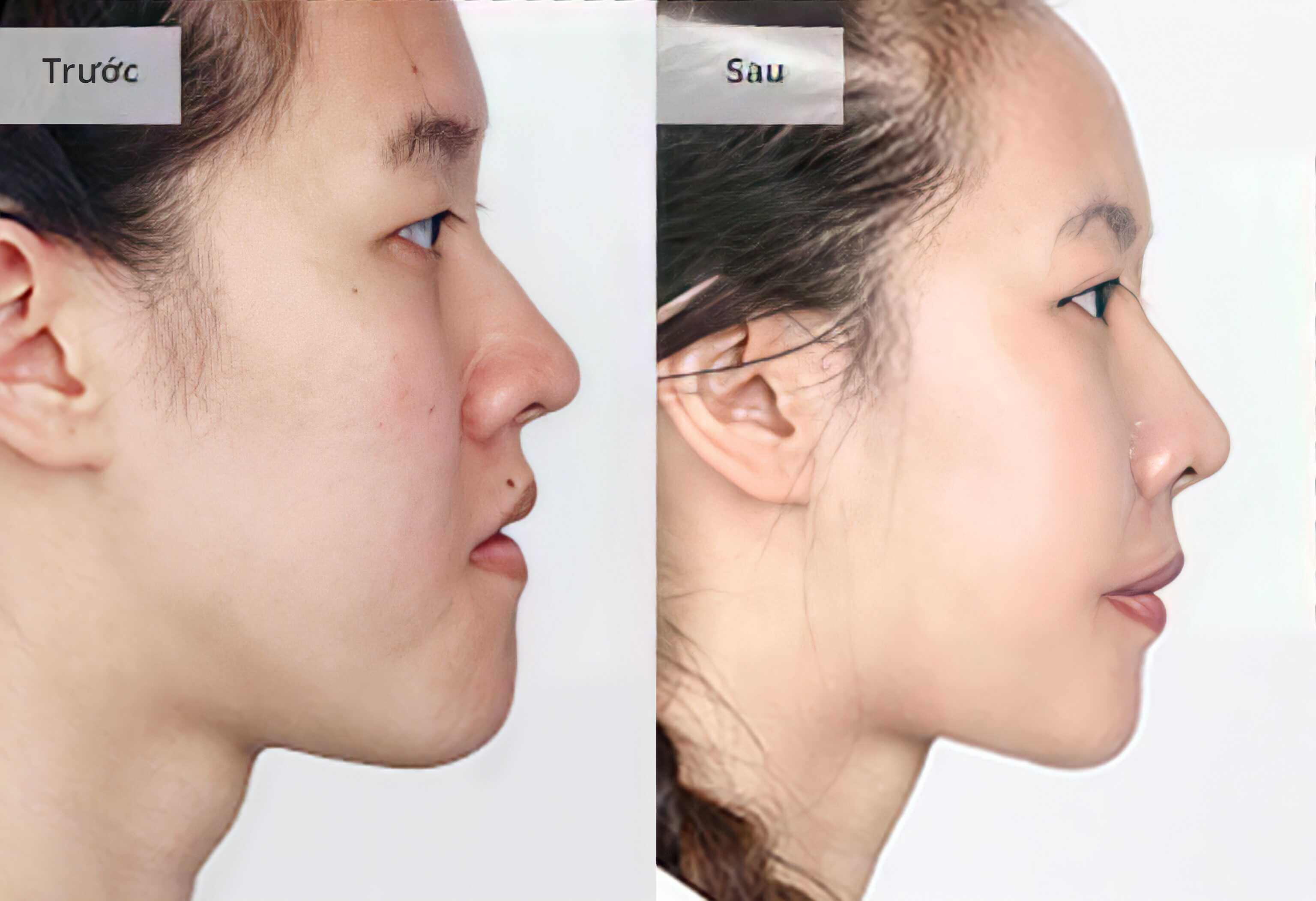 HÌNH ẢNH KHÁCH HÀNG