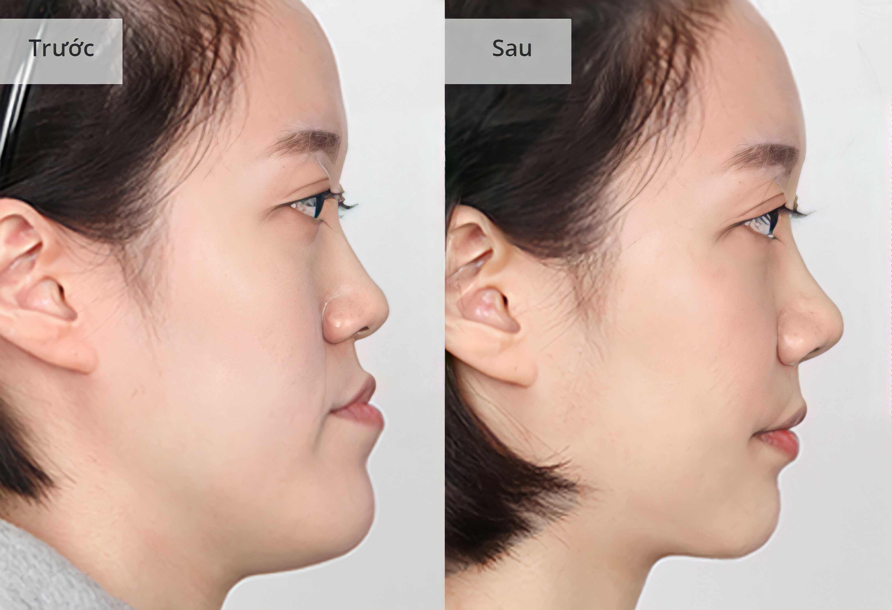 HÌNH ẢNH KHÁCH HÀNG